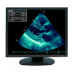 ultrasound monitor
