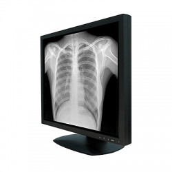 x ray images