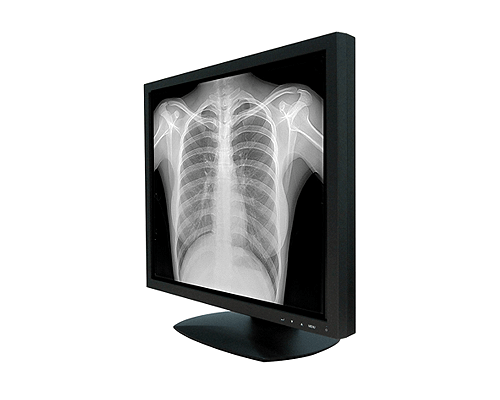 x ray images