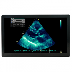 ultrasound monitor