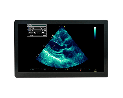 ultrasound monitor