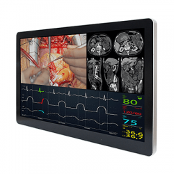 monitor17