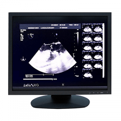 ultrasound monitor