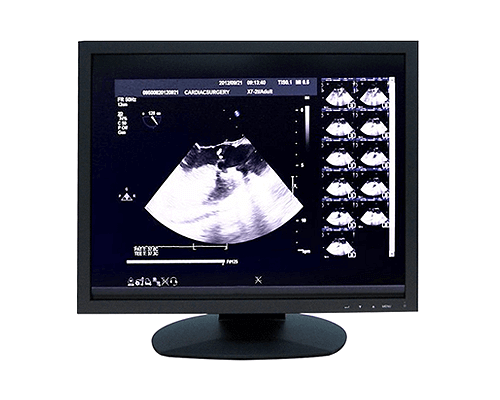 ultrasound monitor